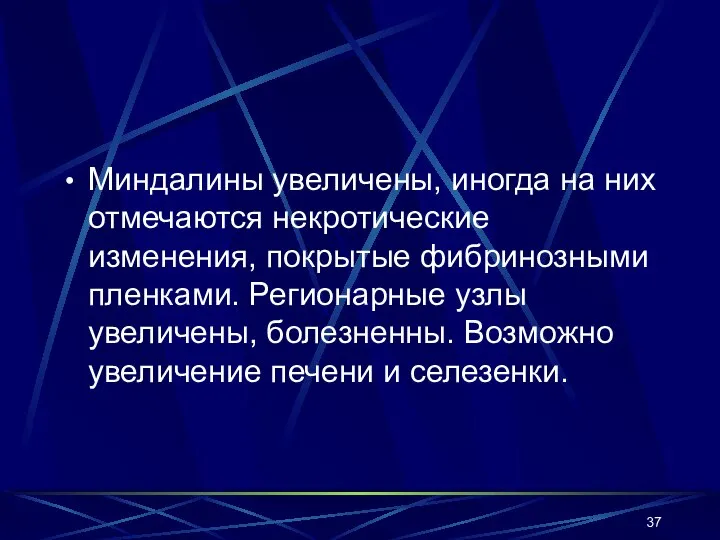 Миндалины увеличены, иногда на них отмечаются некротические изменения, покрытые фибринозными пленками.