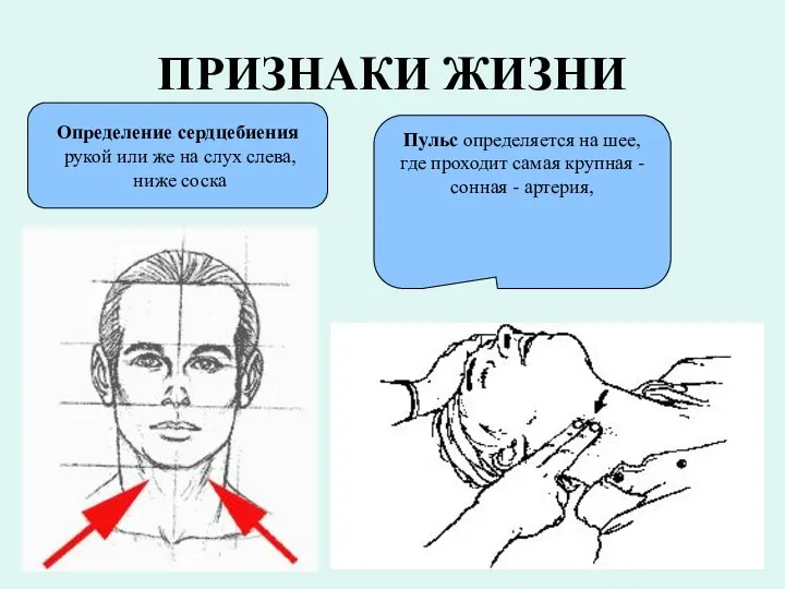 ПРИЗНАКИ ЖИЗНИ Определение сердцебиения рукой или же на слух слева, ниже