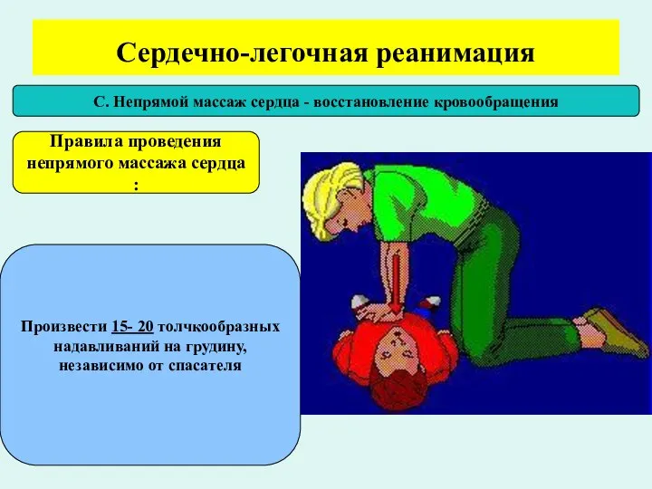 Сердечно-легочная реанимация С. Непрямой массаж сердца - восстановление кровообращения Правила проведения