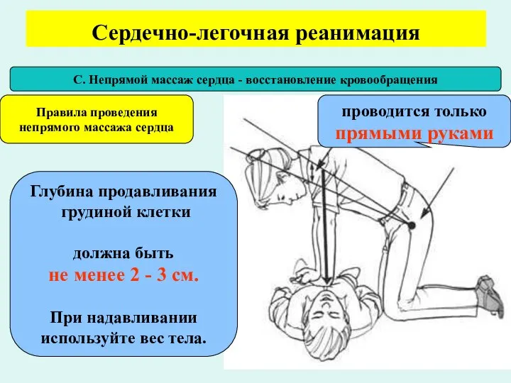 Сердечно-легочная реанимация С. Непрямой массаж сердца - восстановление кровообращения Правила проведения