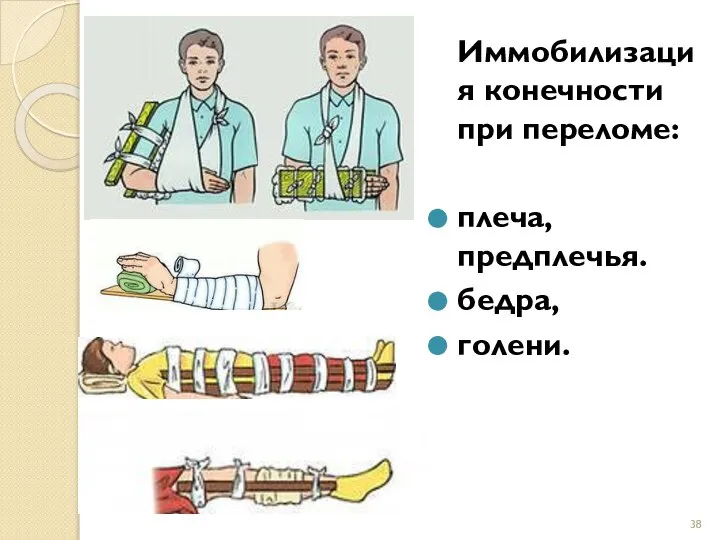 Иммобилизация конечности при переломе: плеча, предплечья. бедра, голени.