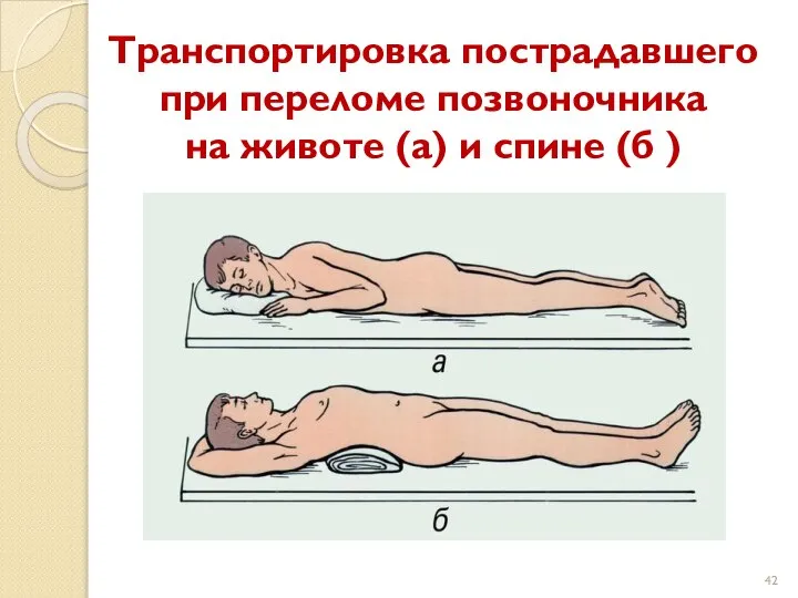 Транспортировка пострадавшего при переломе позвоночника на животе (а) и спине (б )