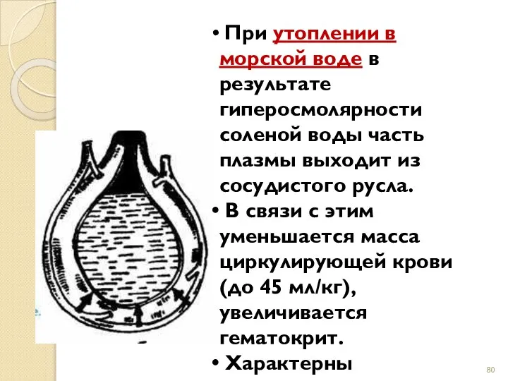 При утоплении в морской воде в результате гиперосмолярности соленой воды часть