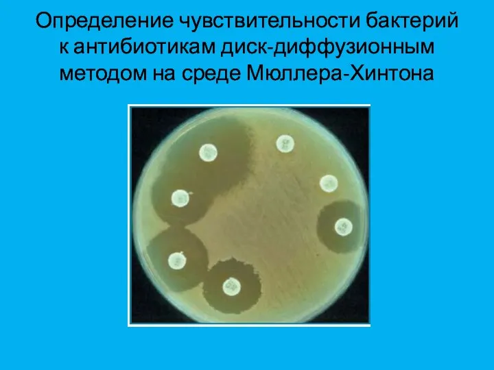 Определение чувствительности бактерий к антибиотикам диск-диффузионным методом на среде Мюллера-Хинтона