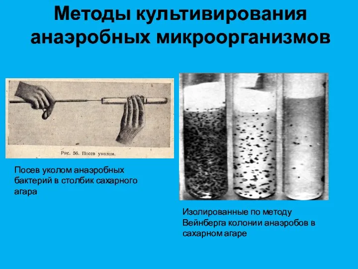 Методы культивирования анаэробных микроорганизмов Изолированные по методу Вейнберга колонии анаэробов в