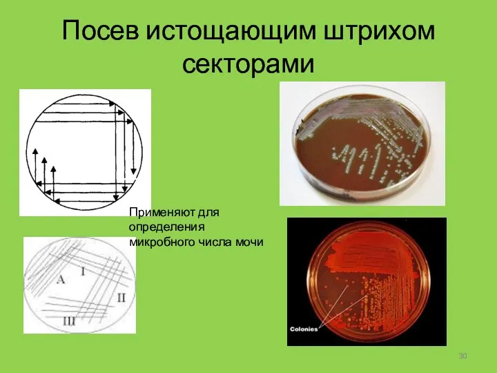 Посев истощающим штрихом секторами Применяют для определения микробного числа мочи