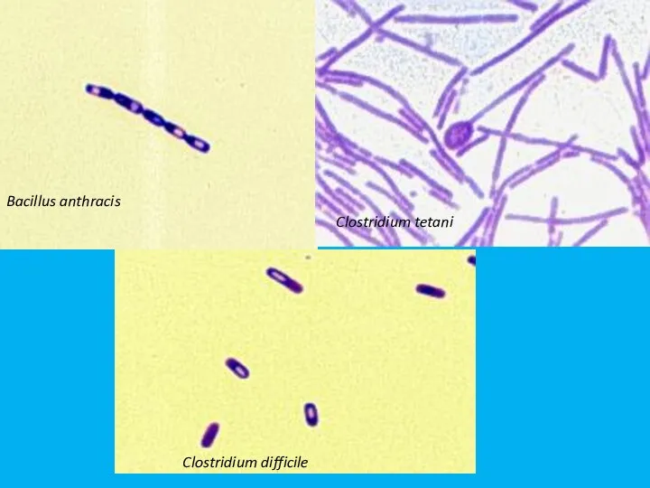 Clostridium tetani Clostridium difficile Bacillus anthracis