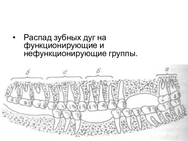 Распад зубных дуг на функционирующие и нефункционирующие группы.