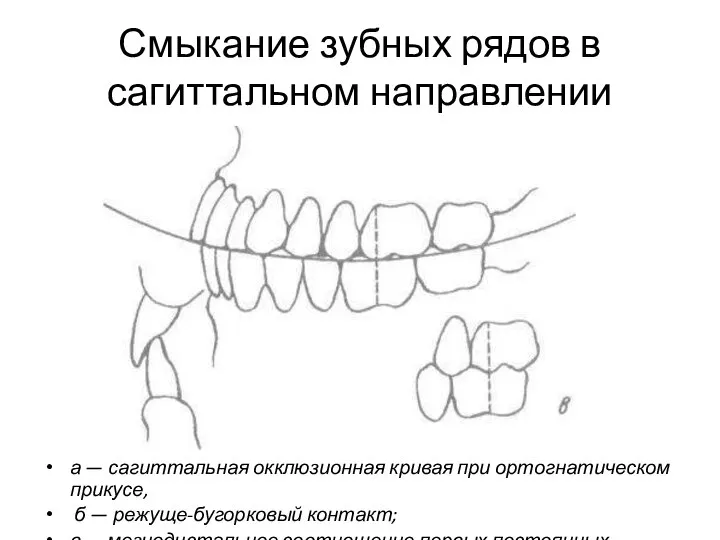 Смыкание зубных рядов в сагиттальном направлении а — сагиттальная окклюзионная кривая