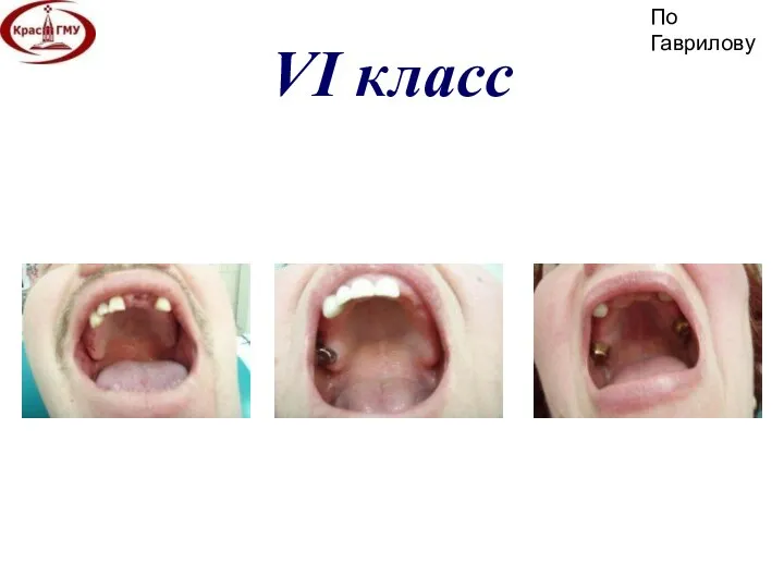 VI класс По Гаврилову