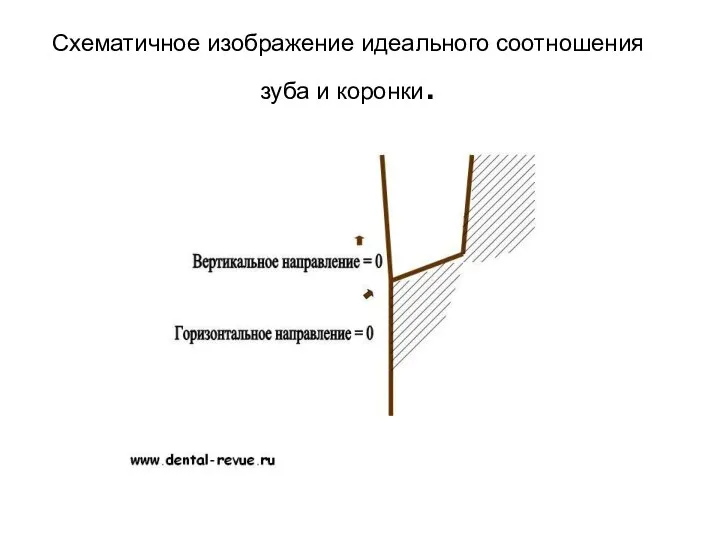 Схематичное изображение идеального соотношения зуба и коронки.