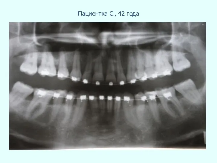 Пациентка С., 42 года