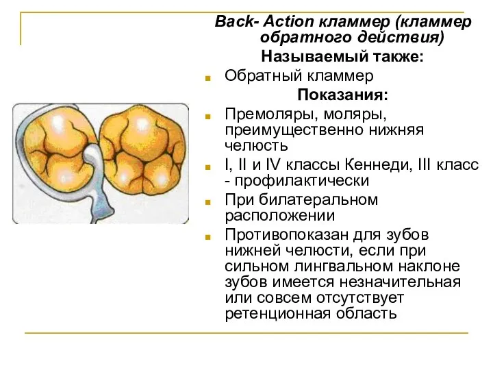 Back- Action кламмер (кламмер обратного действия) Называемый также: Обратный кламмер Показания: