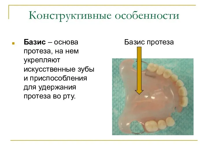 Конструктивные особенности Базис – основа протеза, на нем укрепляют искусственные зубы