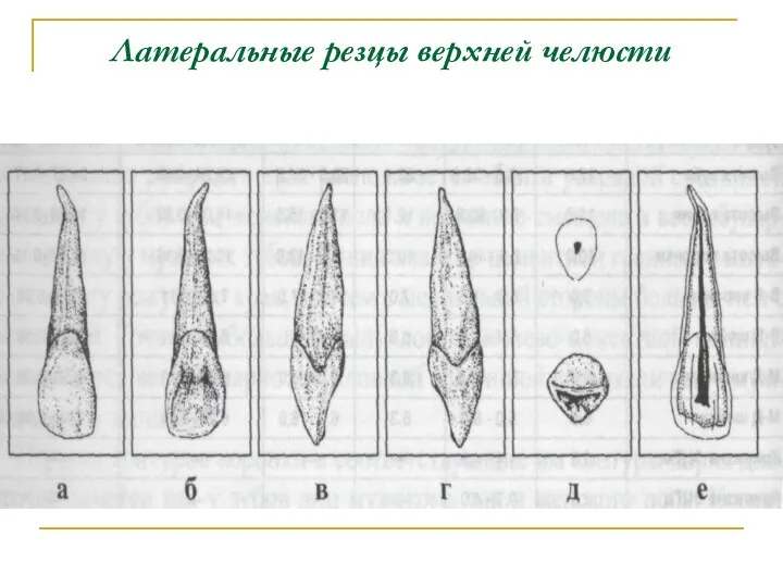 Латеральные резцы верхней челюсти