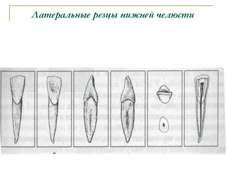 Латеральные резцы нижней челюсти