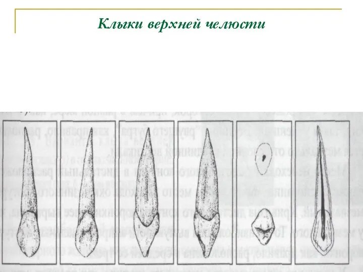 Клыки верхней челюсти