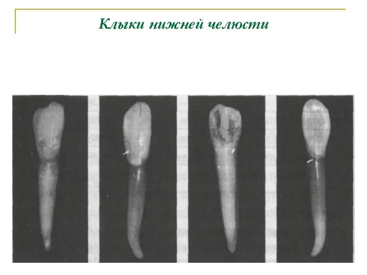 Клыки нижней челюсти