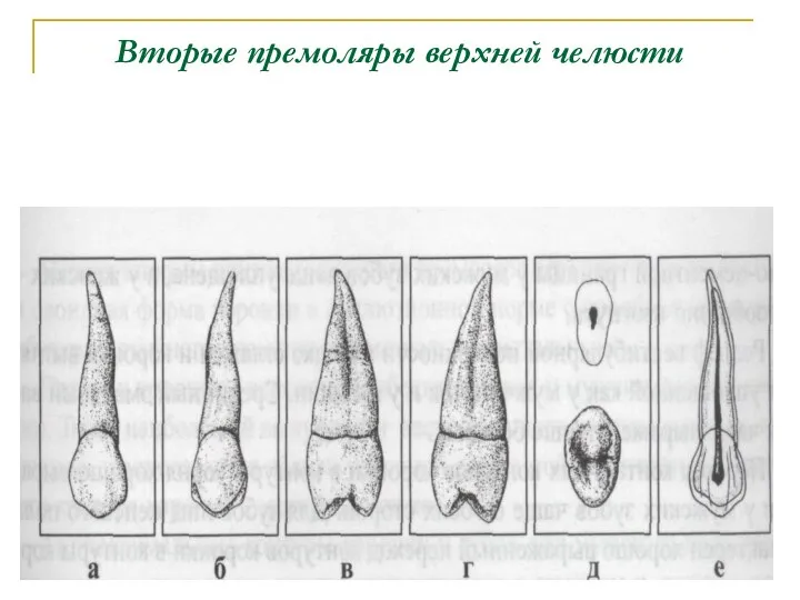 Вторые премоляры верхней челюсти