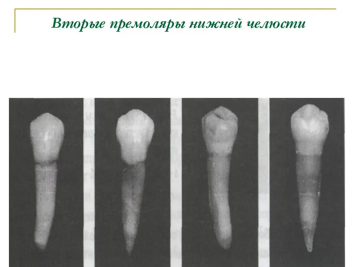 Вторые премоляры нижней челюсти