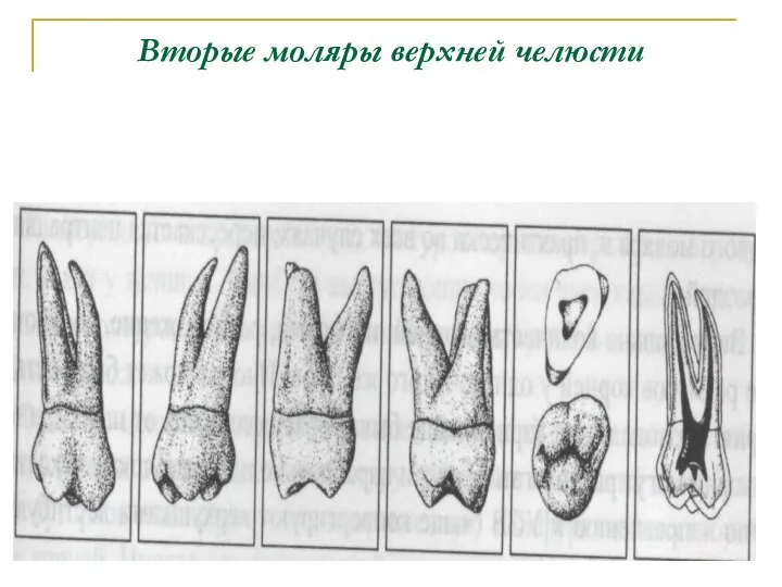 Вторые моляры верхней челюсти