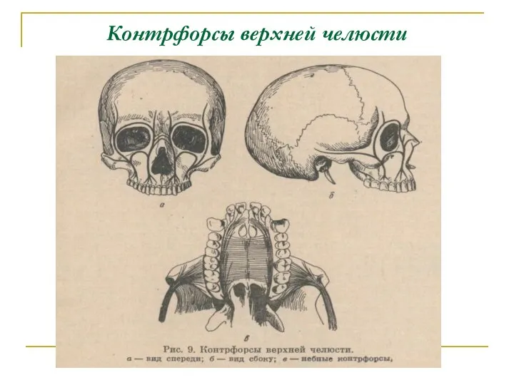 Контрфорсы верхней челюсти