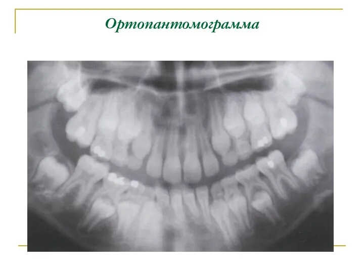 Ортопантомограмма