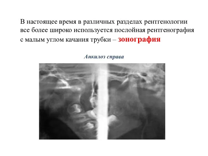 В настоящее время в различных разделах рентгенологии все более широко используется