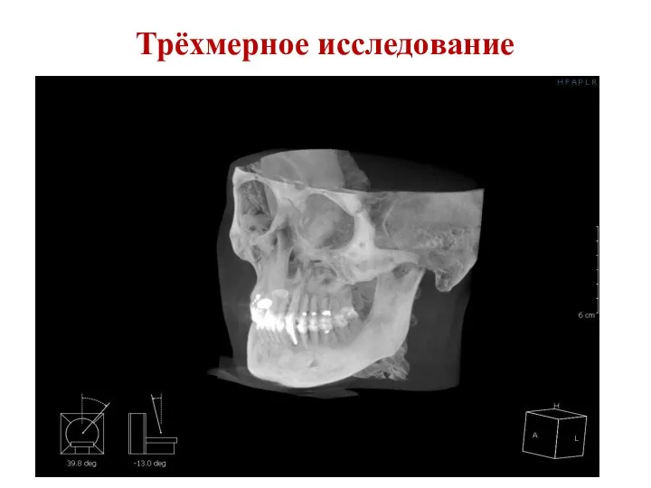 Трёхмерное исследование