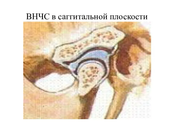 ВНЧС в саггитальной плоскости