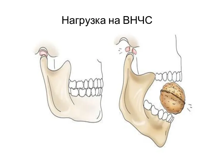 Нагрузка на ВНЧС