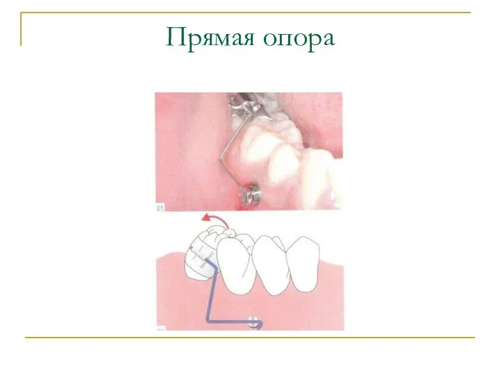 Прямая опора