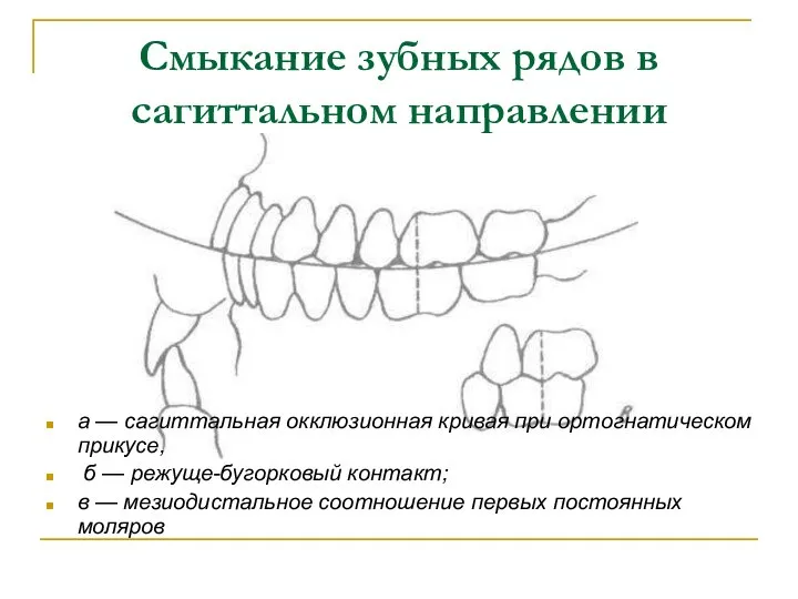 Смыкание зубных рядов в сагиттальном направлении а — сагиттальная окклюзионная кривая