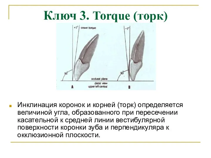 Ключ 3. Torque (торк) Инклинация коронок и корней (торк) определяется величиной
