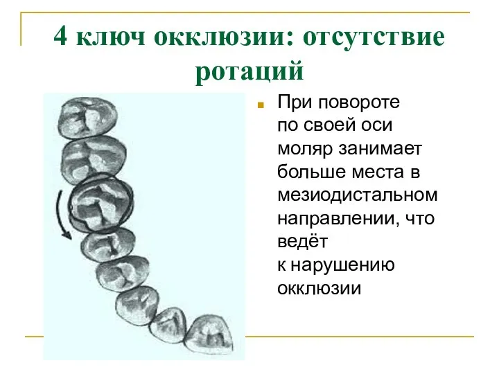 4 ключ окклюзии: отсутствие ротаций При повороте по своей оси моляр