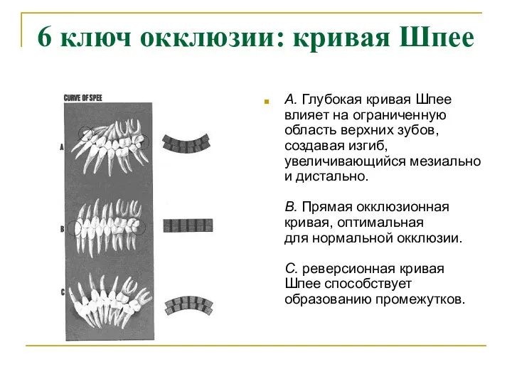 6 ключ окклюзии: кривая Шпее А. Глубокая кривая Шпее влияет на