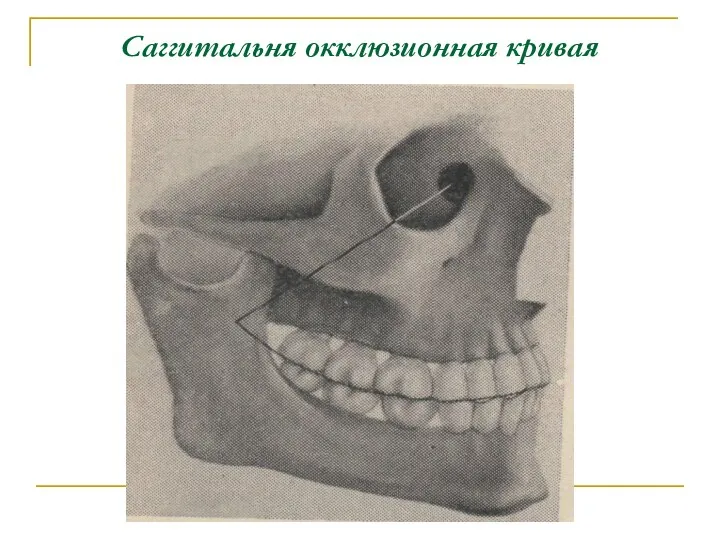 Саггитальня окклюзионная кривая