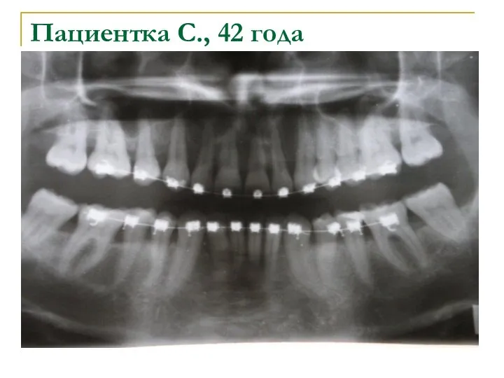 Пациентка С., 42 года