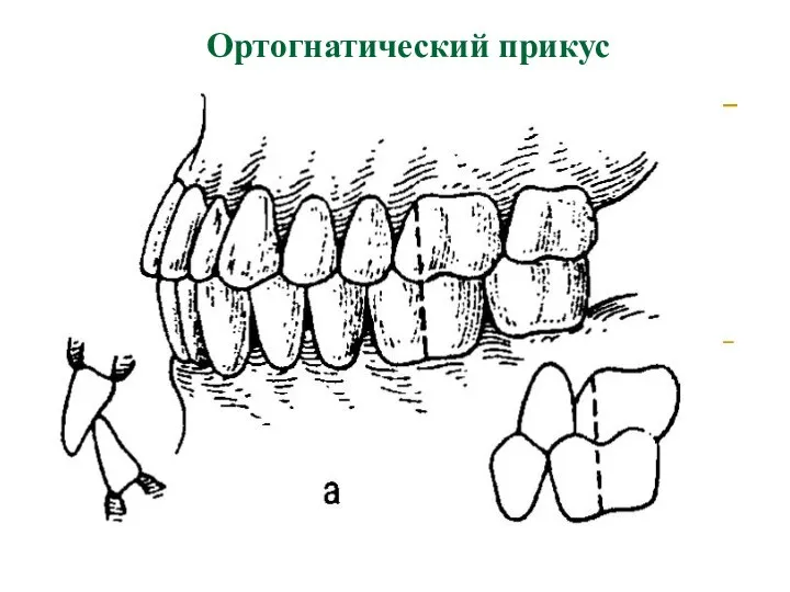 Ортогнатический прикус