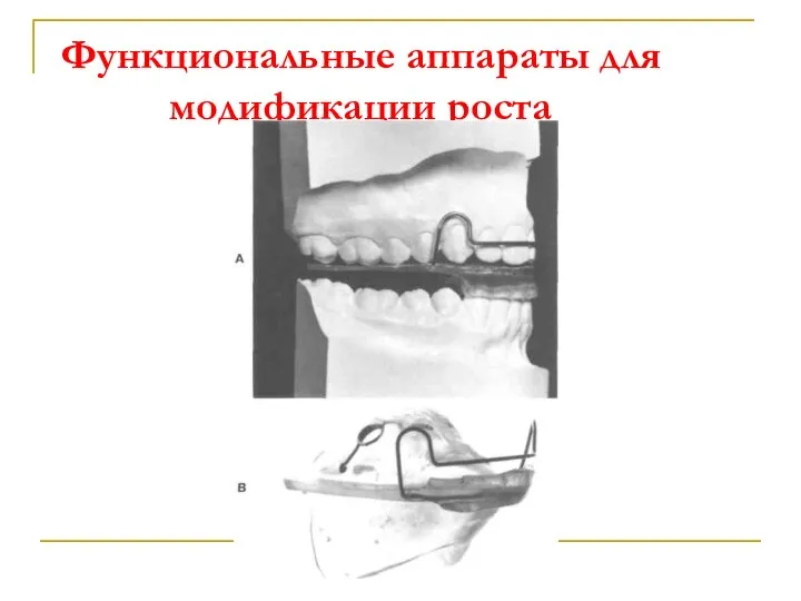 Функциональные аппараты для модификации роста