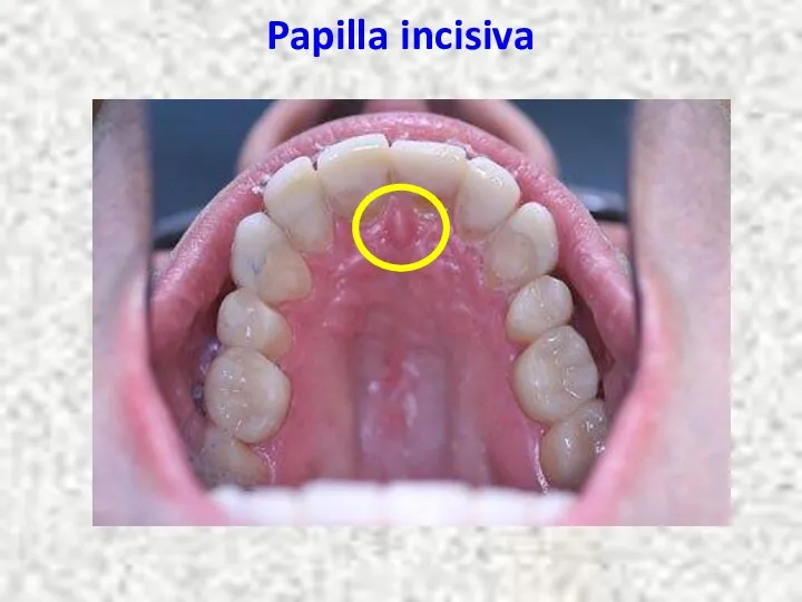 Papilla incisiva