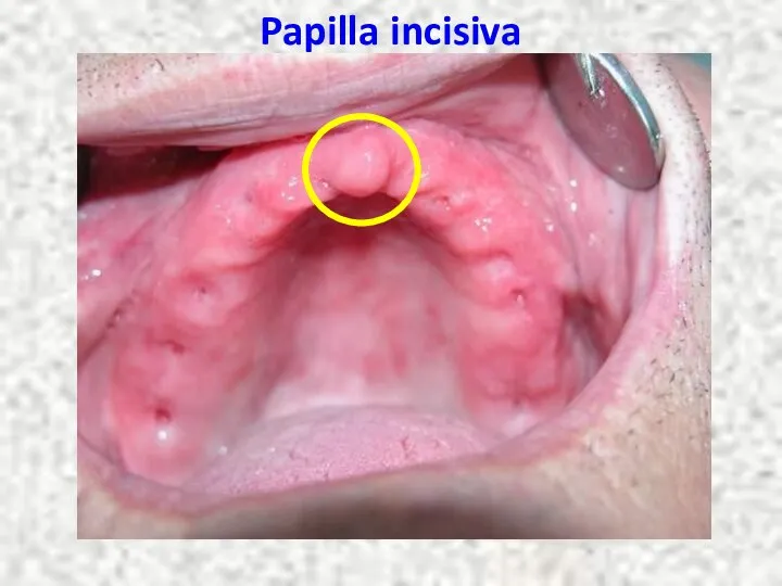 Papilla incisiva