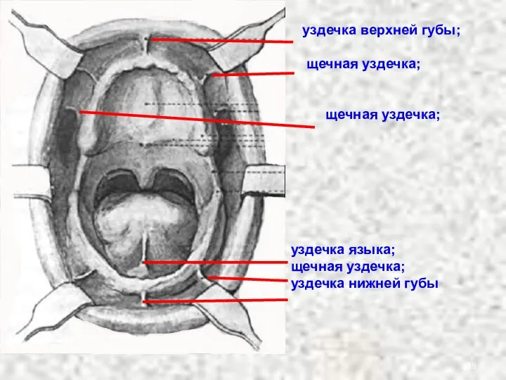 уздечка верхней губы; щечная уздечка; щечная уздечка; уздечка языка; щечная уздечка; уздечка нижней губы