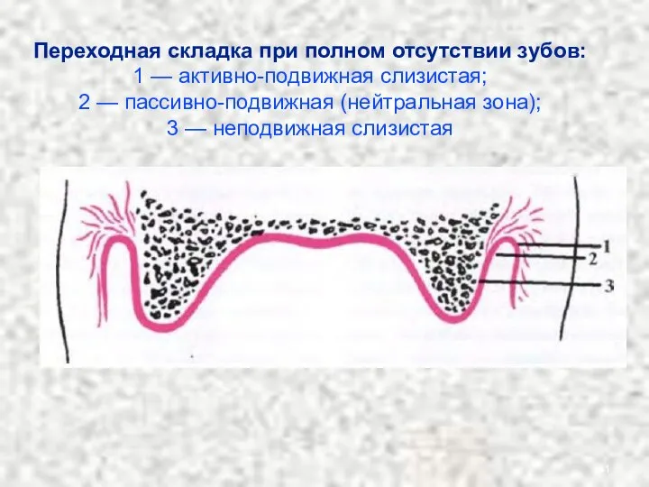 Переходная складка при полном отсутствии зубов: 1 — активно-подвижная слизистая; 2