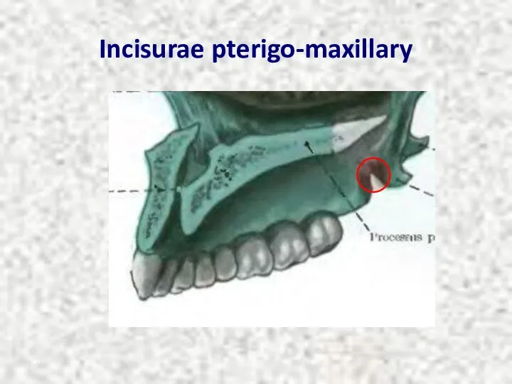 Incisurae pterigo-maxillary