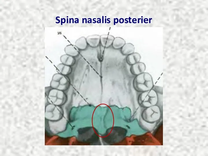 Spina nasalis posterier