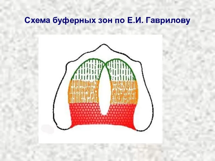 Схема буферных зон по Е.И. Гаврилову
