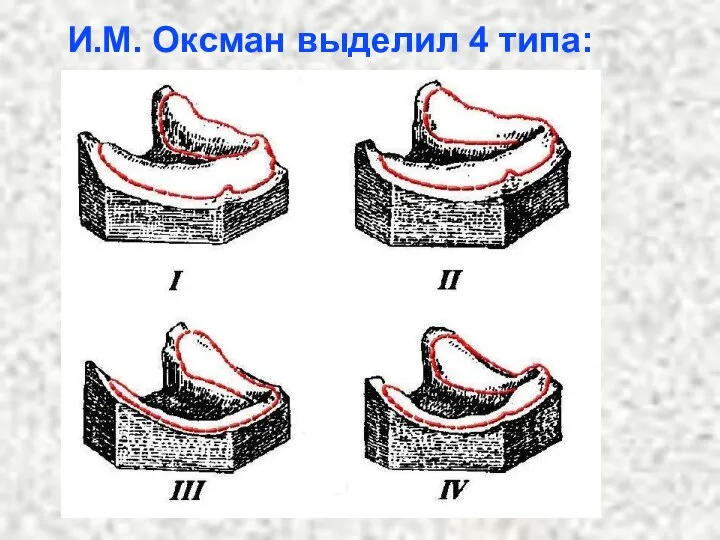 И.М. Оксман выделил 4 типа: