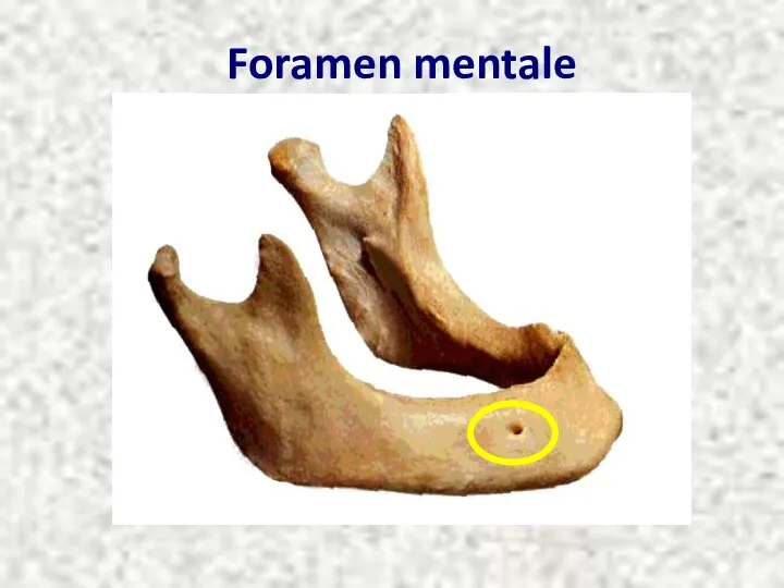 Foramen mentale