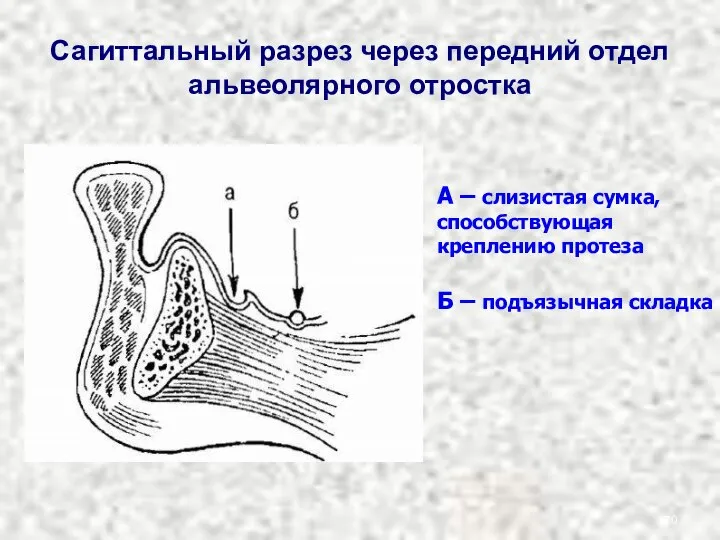 Сагиттальный разрез через передний отдел альвеолярного отростка А – слизистая сумка,